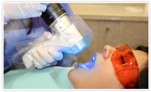 口腔がんチェック