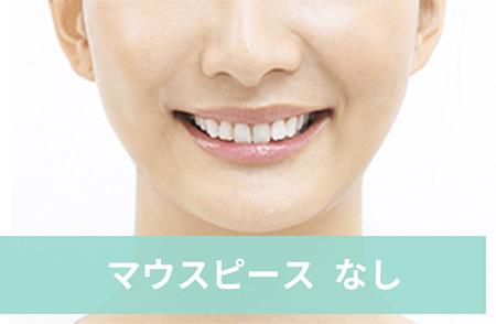 インビザライン03