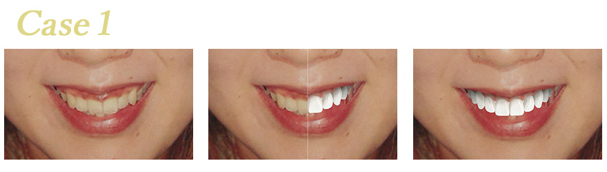 シュミレーションソフト治療後イメージ01