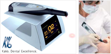 虫歯ディテクター(虫歯探知機)