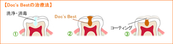 ドックベストの治療法