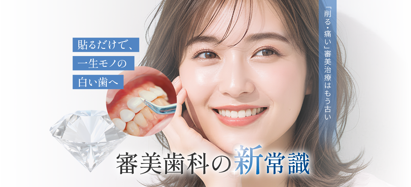 貼るだけで、一生モノの 白い歯へ 次世代審美治療「ラブリエ」 超極薄0.03mmのラミネートベニア