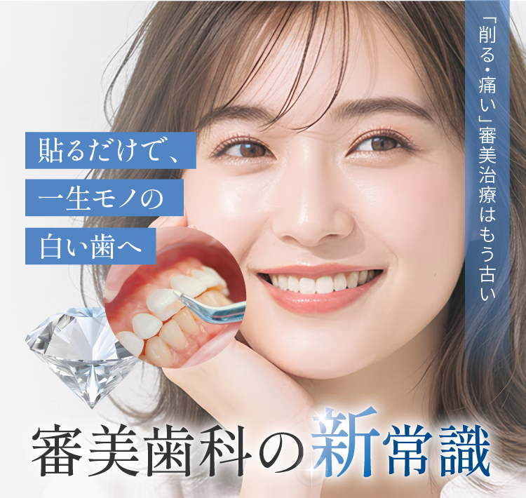 貼るだけで、一生モノの 白い歯へ 次世代審美治療「ラブリエ」 超極薄0.03mmのラミネートベニア