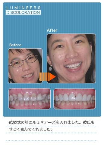 彼氏もすごく喜んでくれました。