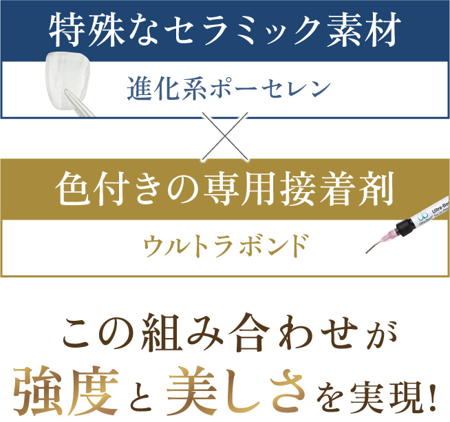 ルミネアーズ独自のポーセレンとウルトラボンドの組み合わせにより耐久性と美しさを実現!
