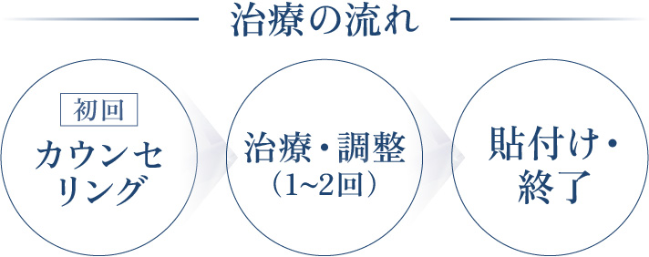 ルミネアーズの治療の流れ