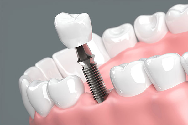 歯と身体の関係を重視した治療をします