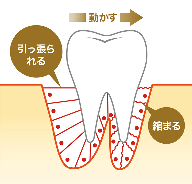 矯正による歯槽骨と歯根膜の変化