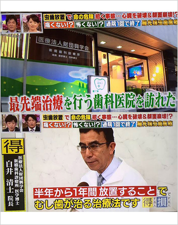 【日本テレビ】当院が『あのニュースで得する人損する人』にて紹介されました。
