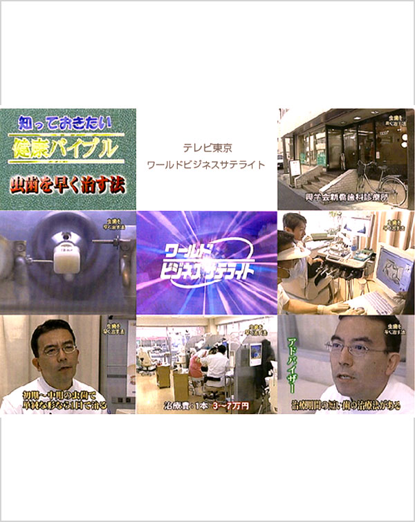【テレビ東京】新橋歯科診療所、赤坂歯科診療所が「ワールドビジネスサテライト」にて紹介されました。
