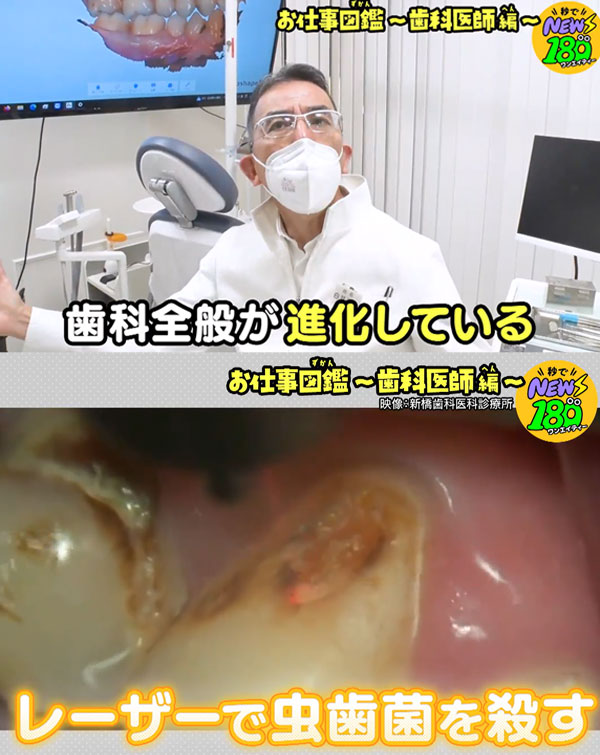 2023年1月24日(火)放送のテレビ東京 【秒でNEWS180】に新橋歯科医科診療所が出演しました