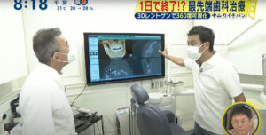 新橋歯科医科診療所が日本テレビ「シューイチ」に出演！