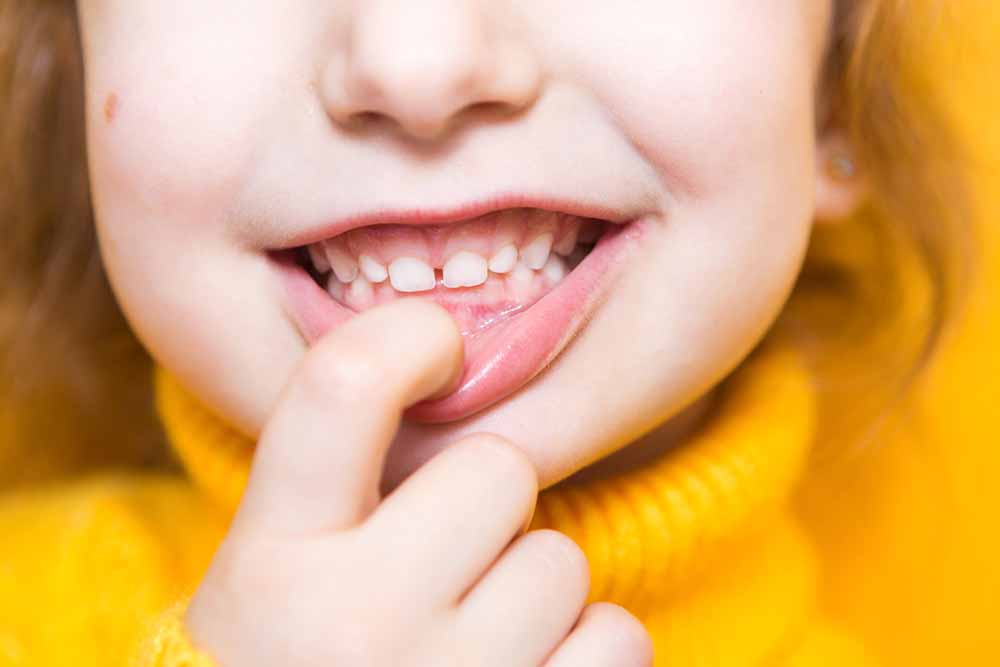 3歳から7歳までの咬合異常の変化