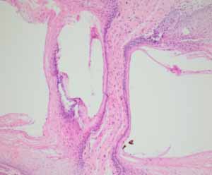口腔内の生検_図5