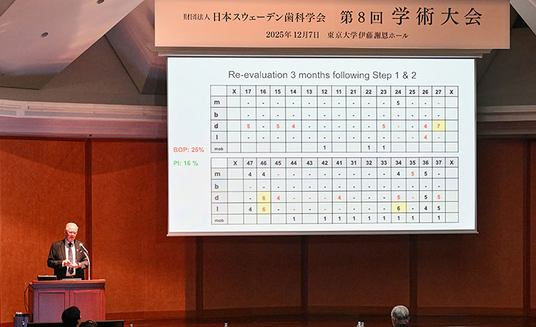講演⑨ AI×ペリオの最前線 AIは歯周病治療にどう役立つのか