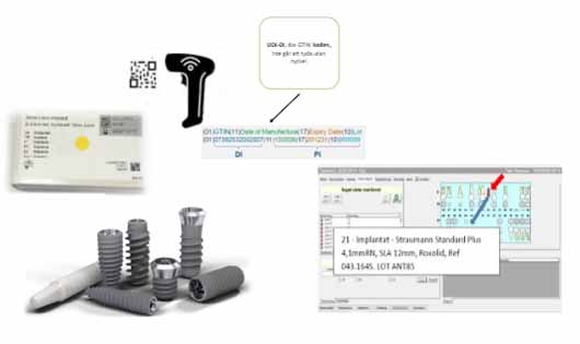 SKRI - スウェーデン歯科インプラント品質登録_図2