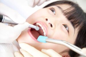 外傷後の癒着切歯の歯冠修復