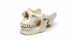 口腔内垂直枝骨切り術（IVRO）