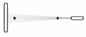 歯科X線写真における正常な解剖学_図1b