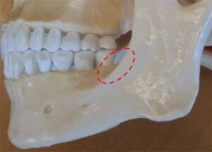歯科X線写真における正常な解剖学_図22