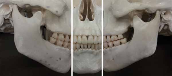 歯科X線写真における正常な解剖学_図25